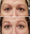Brightens dark circles